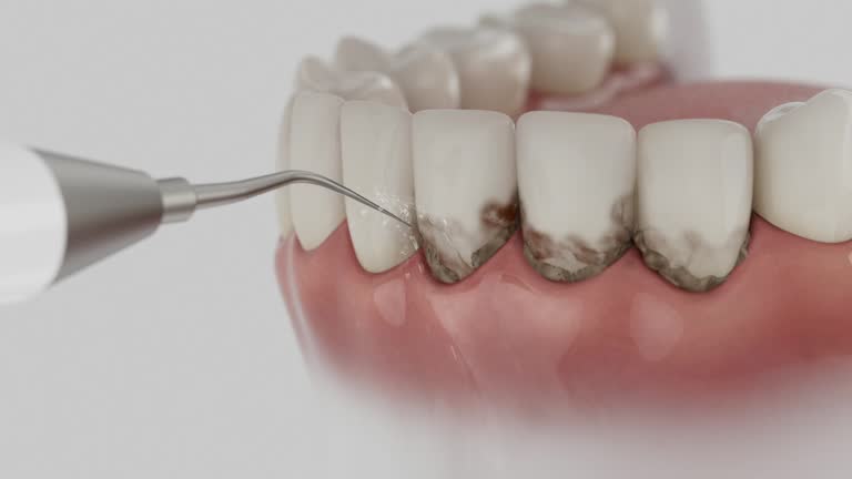Trusted Wisdom Tooth Removal service in Stanfield, NC - Dentist Open Now